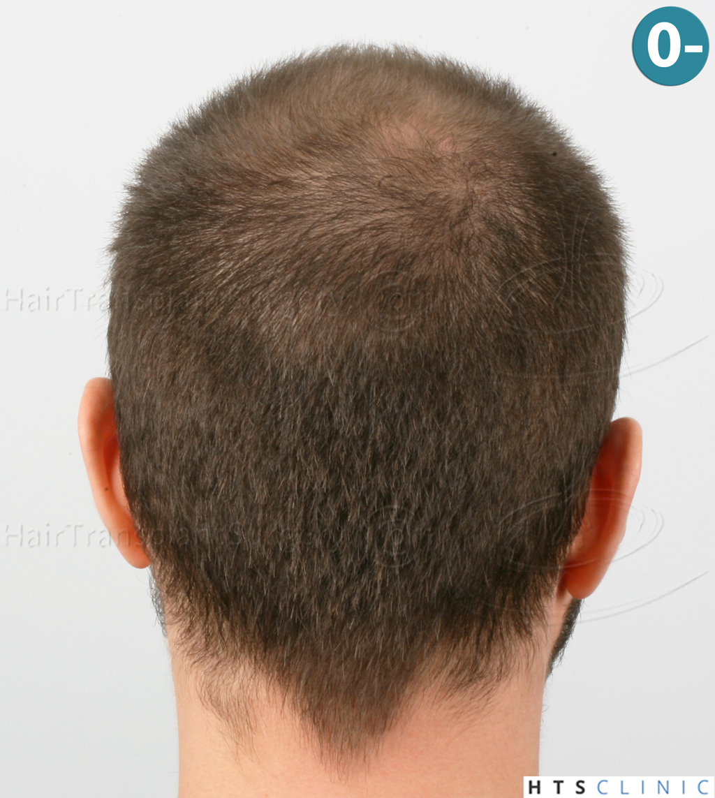 index.php/fa/38365/0/