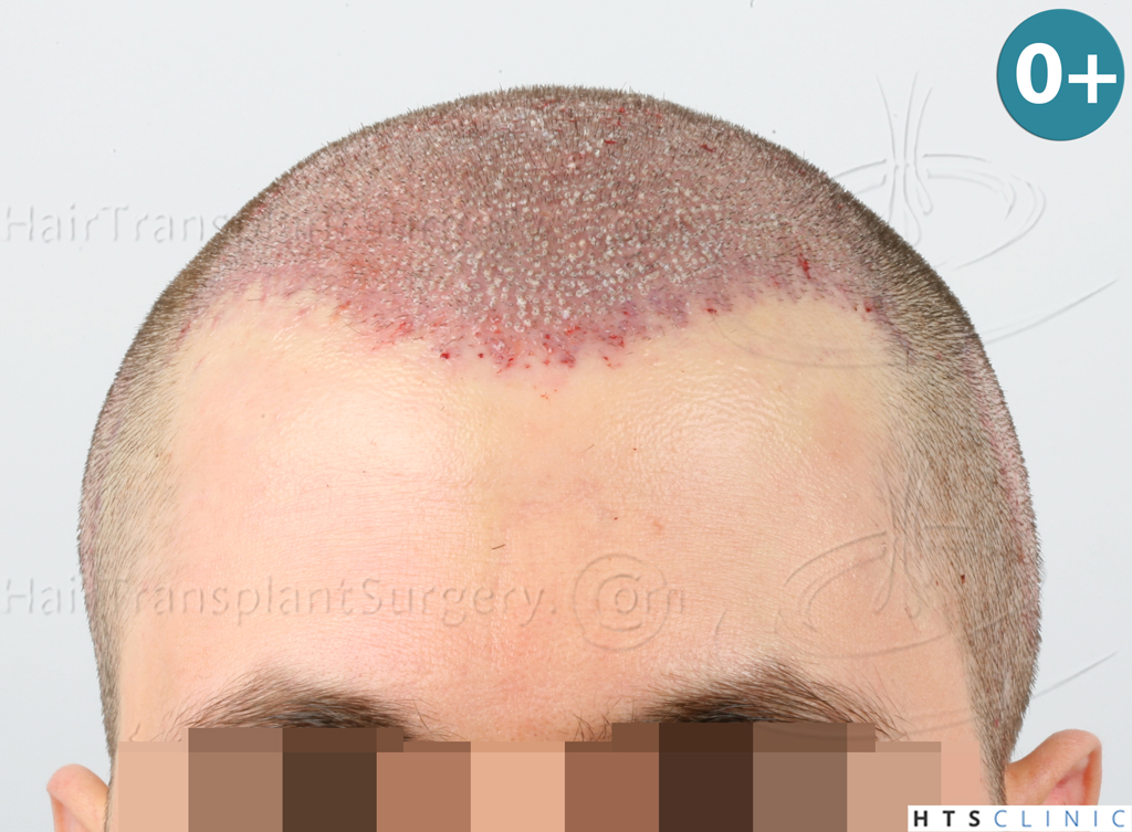 index.php/fa/38367/0/