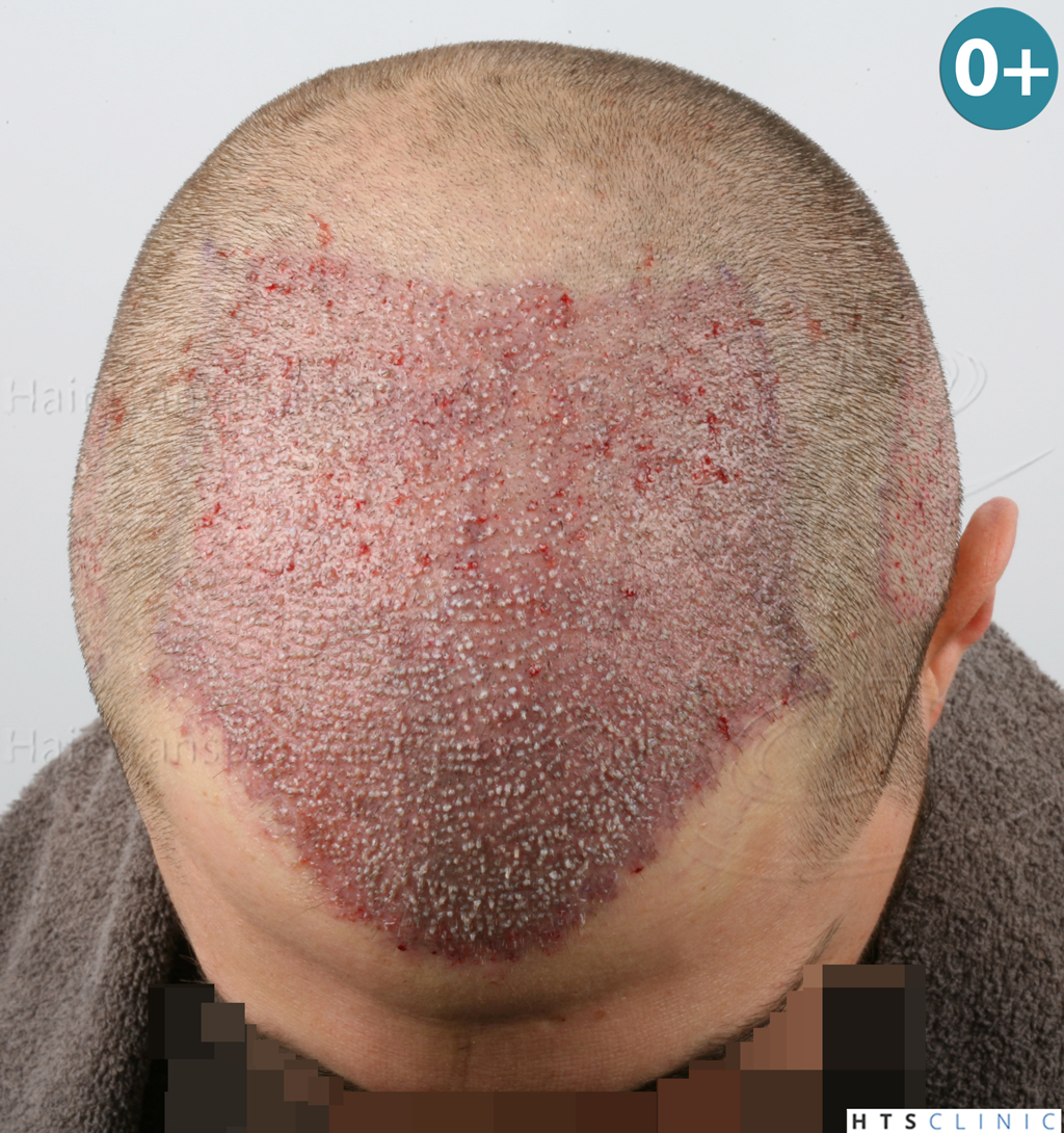 index.php/fa/38368/0/