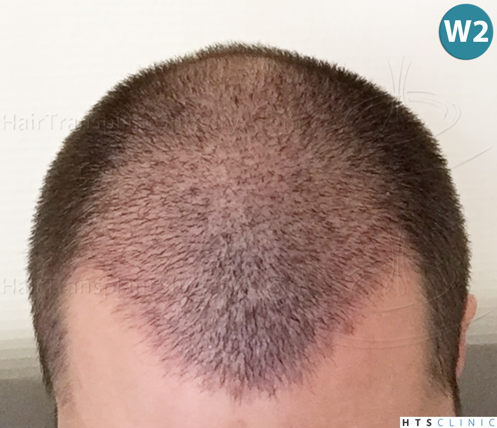 index.php/fa/38371/0/