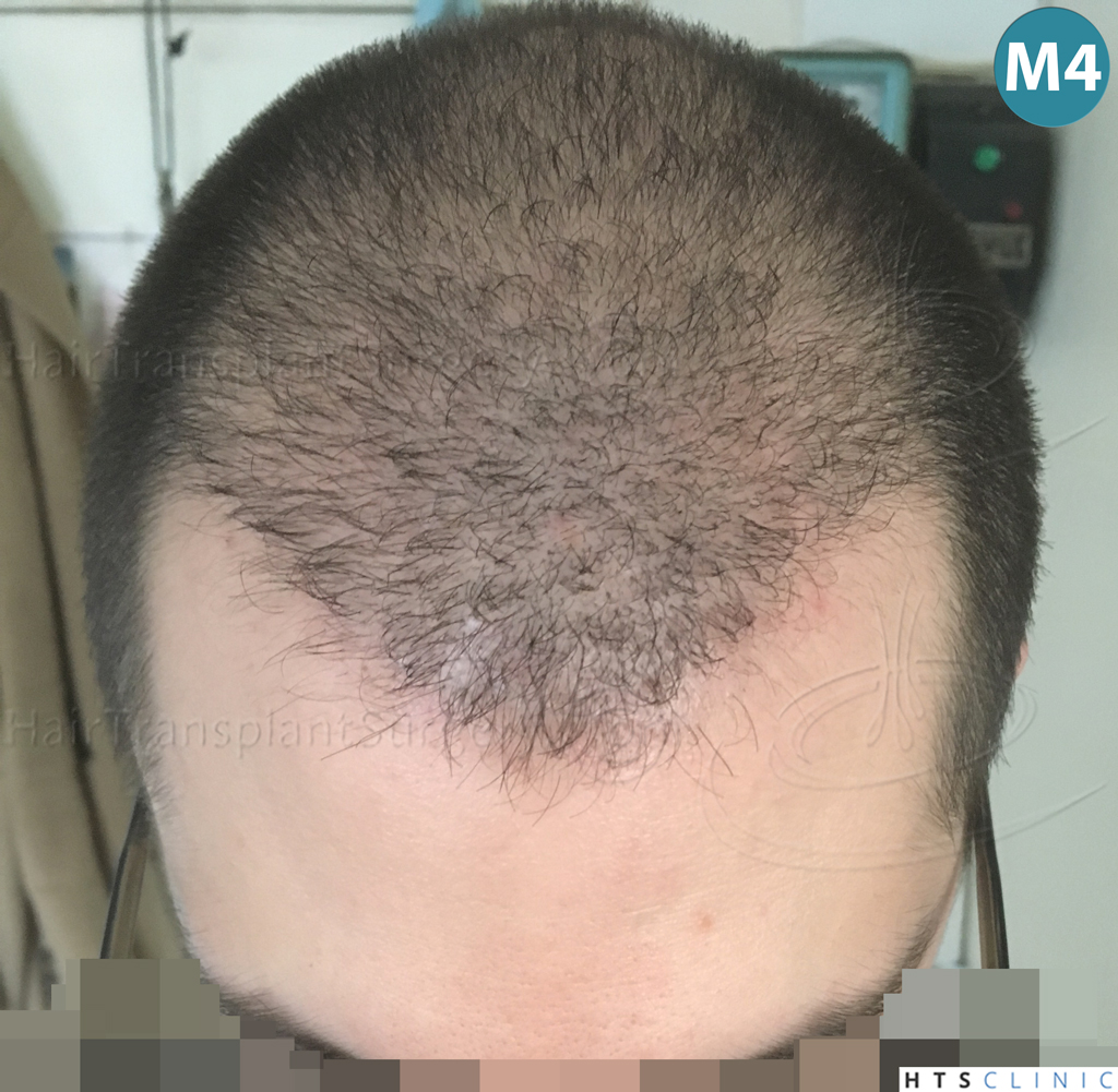 index.php/fa/38372/0/