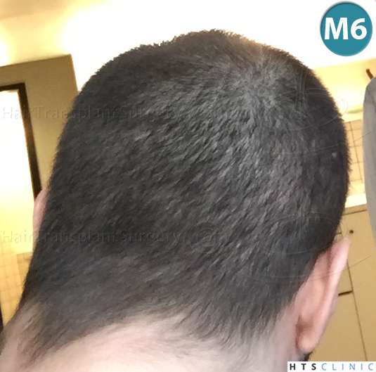 index.php/fa/38375/0/