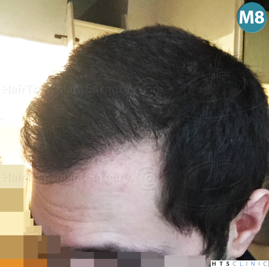 index.php/fa/38377/0/