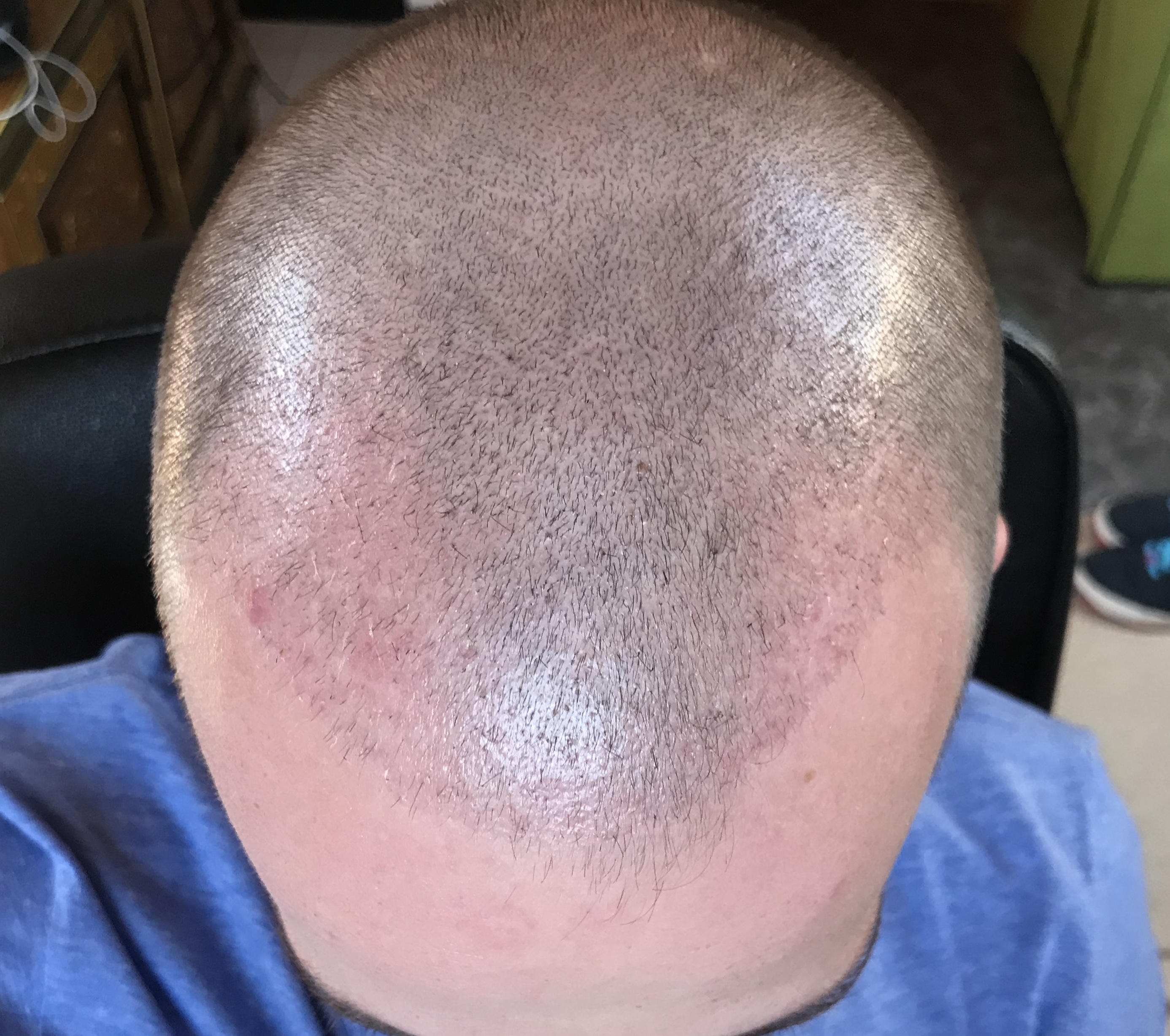 index.php/fa/38433/0/