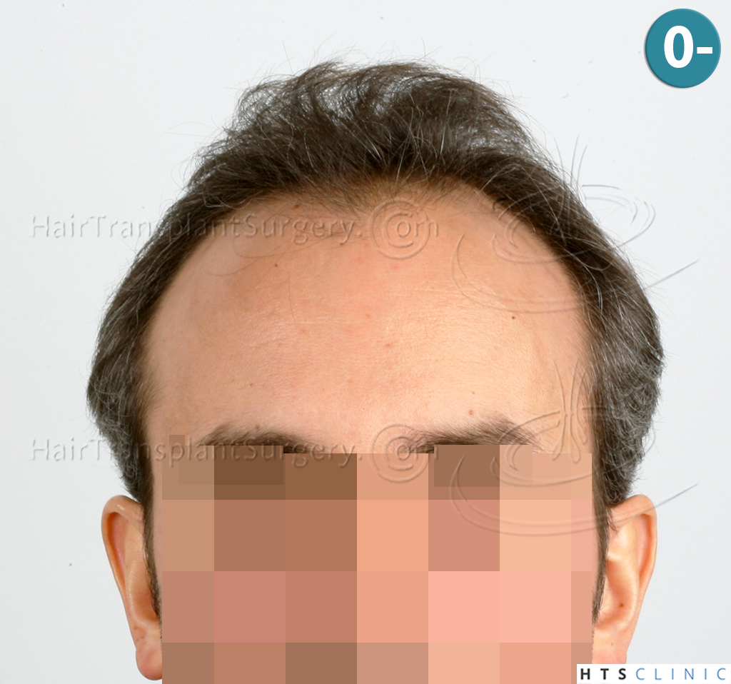 /foren/transplant/index.php/fa/38557/0/