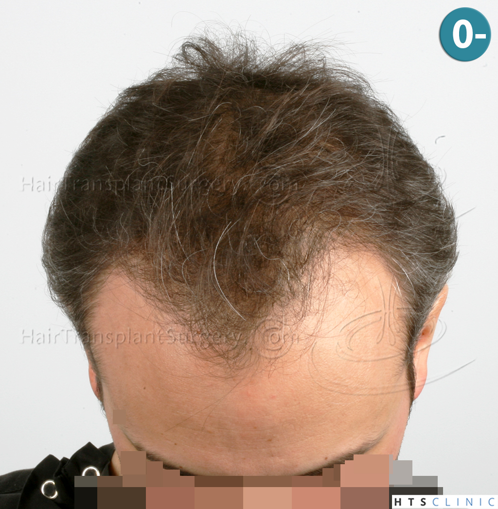 /foren/transplant/index.php/fa/38558/0/