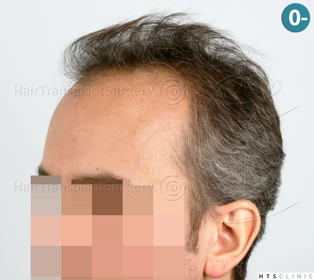 /foren/transplant/index.php/fa/38559/0/