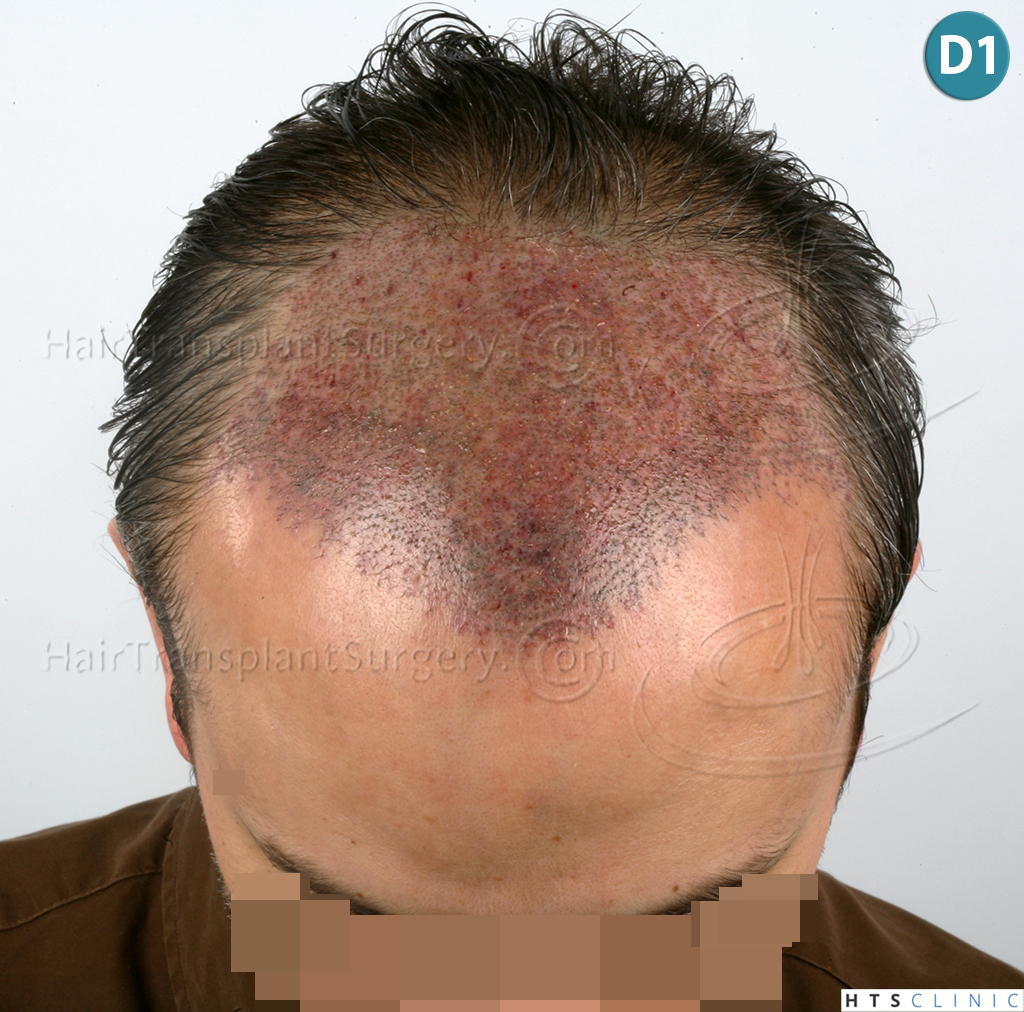 /foren/transplant/index.php/fa/38562/0/