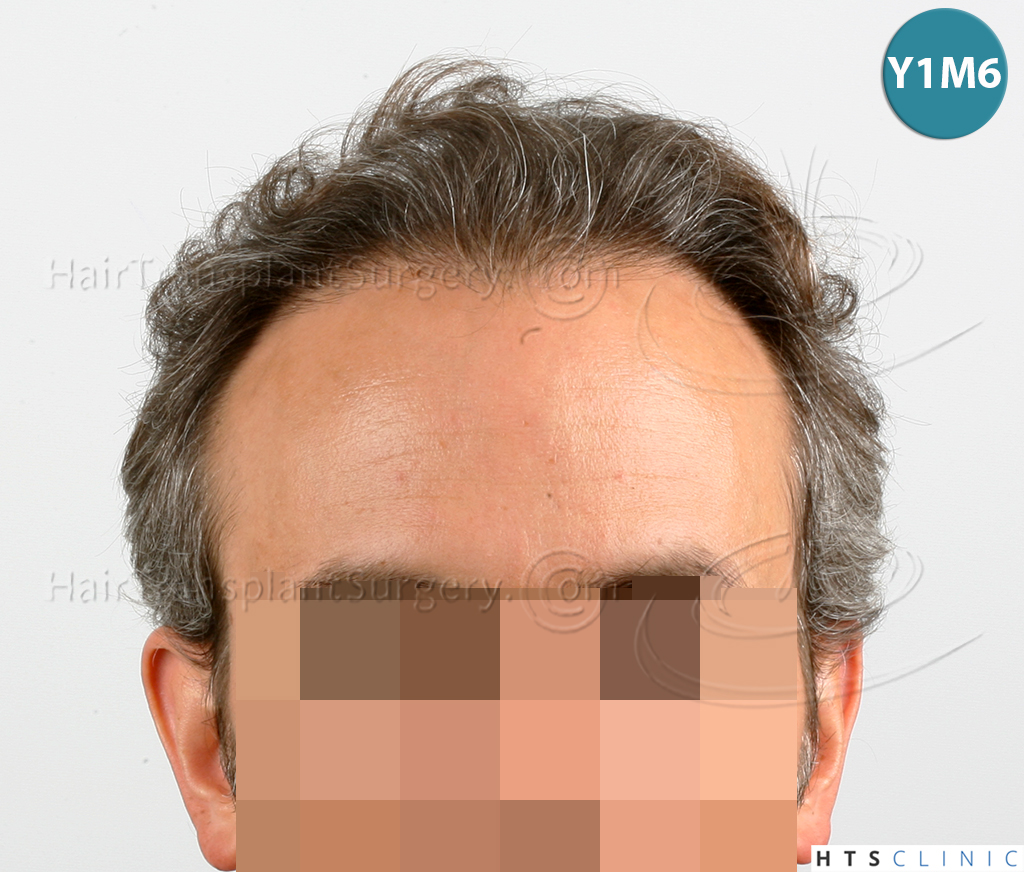 /foren/transplant/index.php/fa/38563/0/