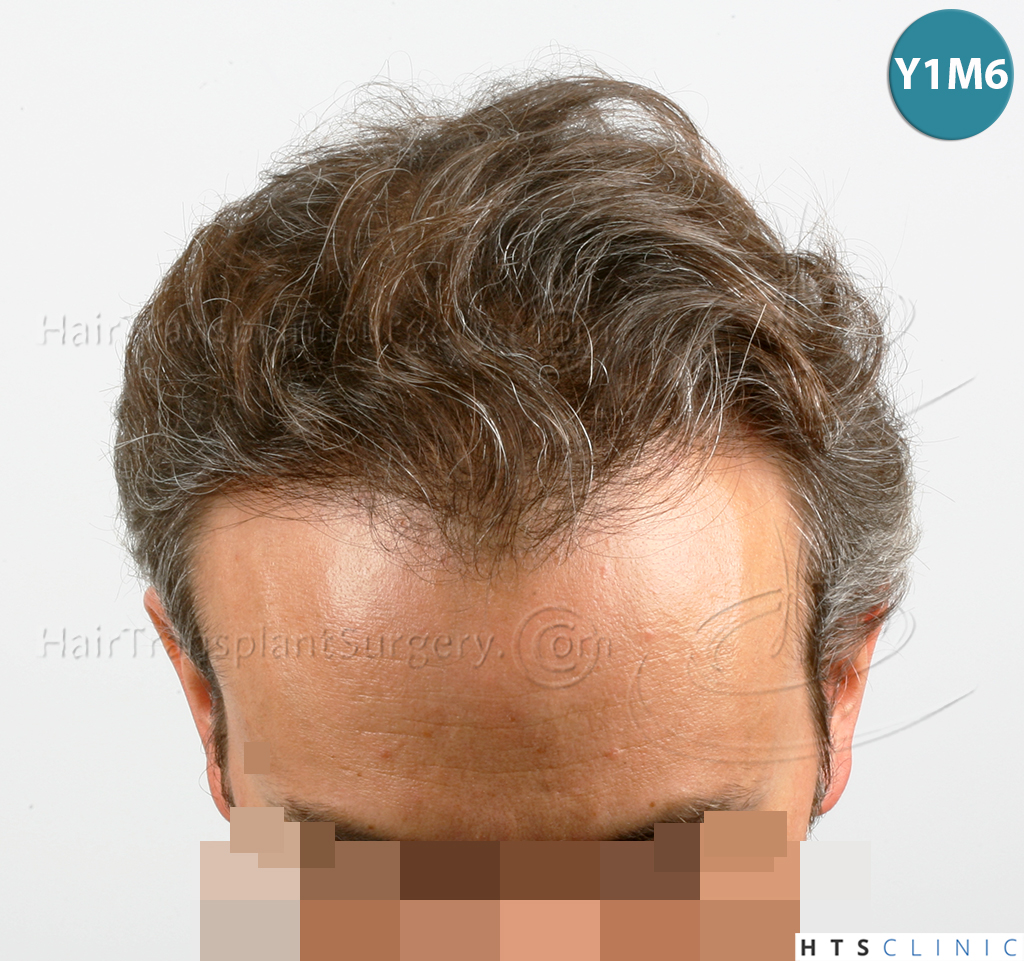 /foren/transplant/index.php/fa/38564/0/