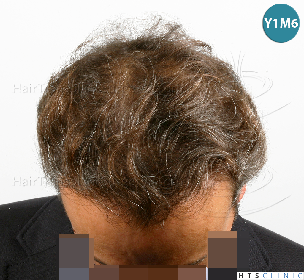 /foren/transplant/index.php/fa/38565/0/