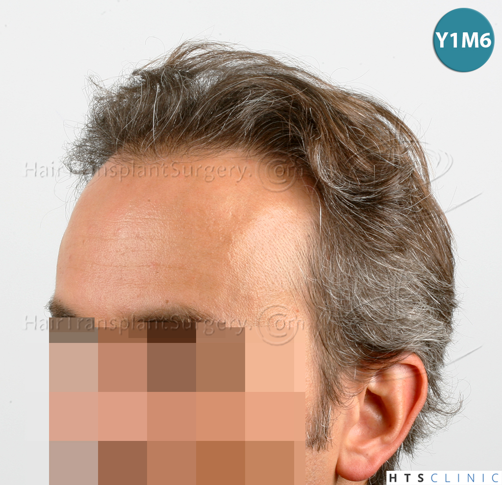 /foren/transplant/index.php/fa/38567/0/