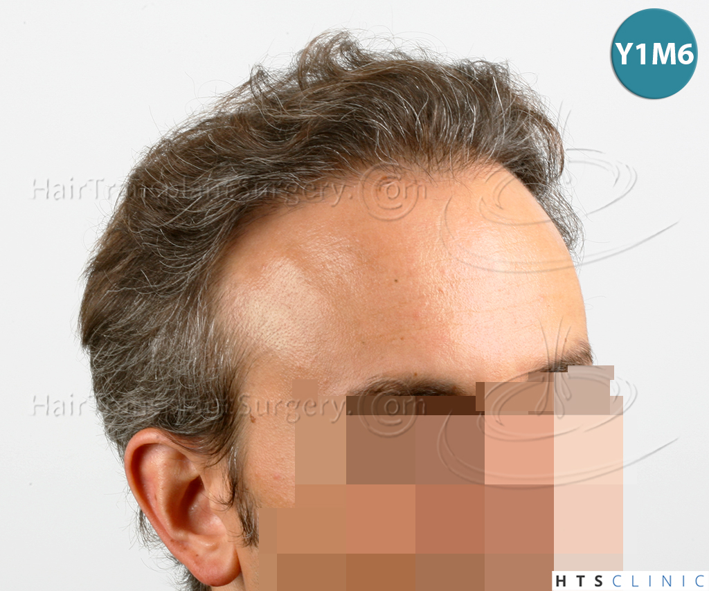 /foren/transplant/index.php/fa/38568/0/