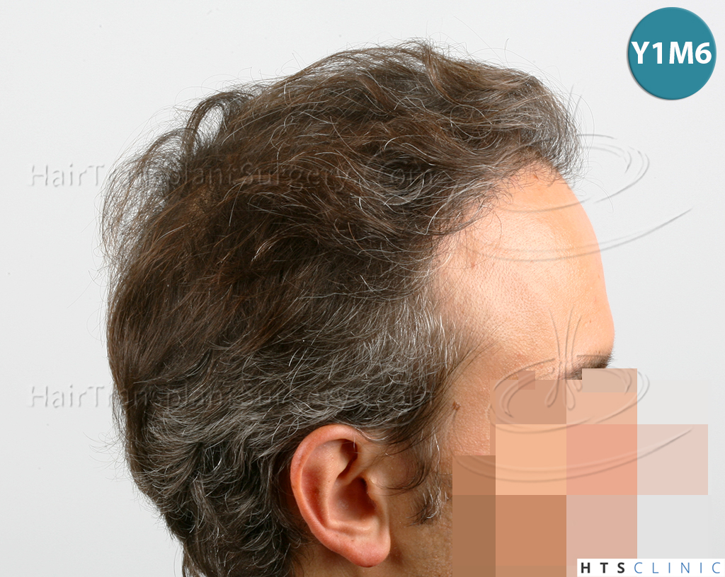 /foren/transplant/index.php/fa/38569/0/