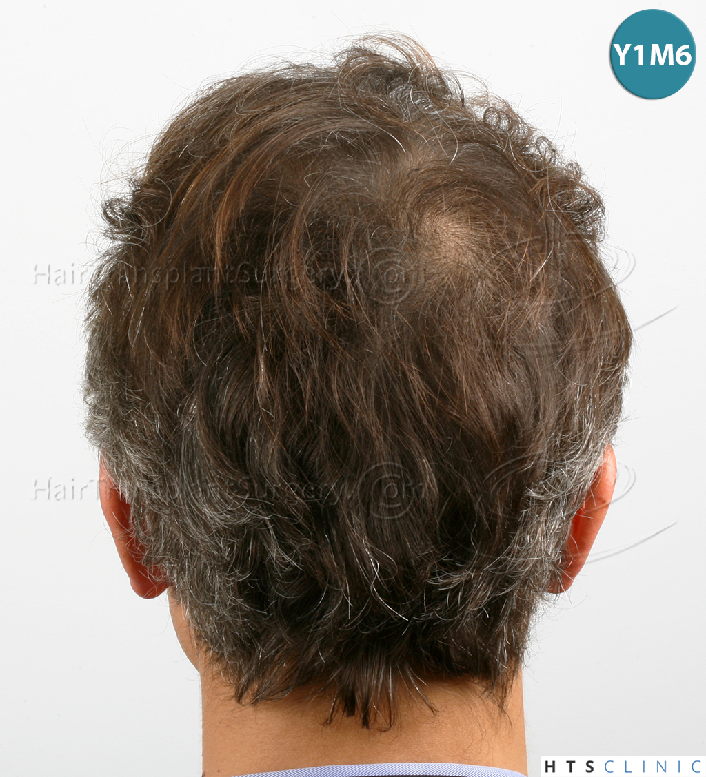 /foren/transplant/index.php/fa/38570/0/