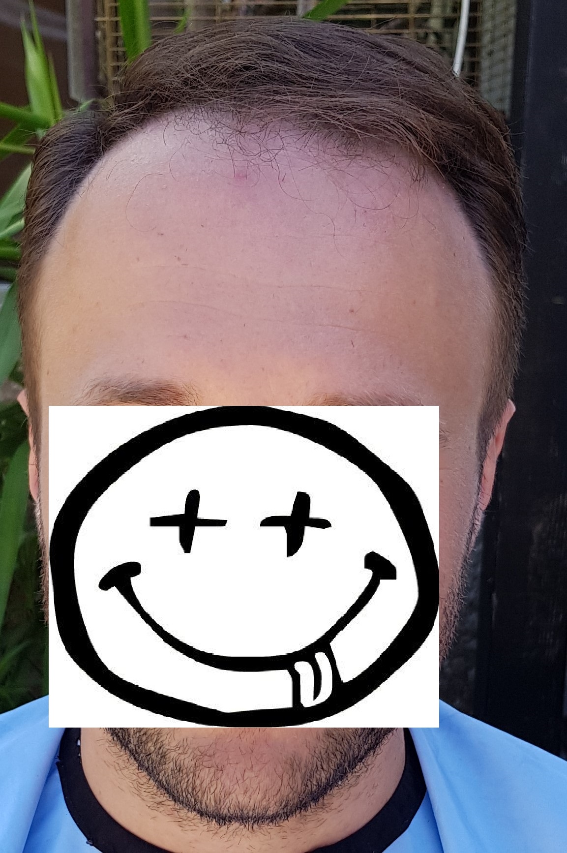 /foren/transplant/index.php/fa/38579/0/