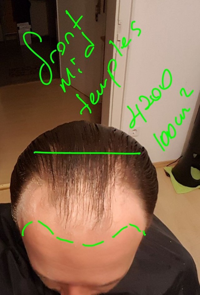 /foren/transplant/index.php/fa/38582/0/