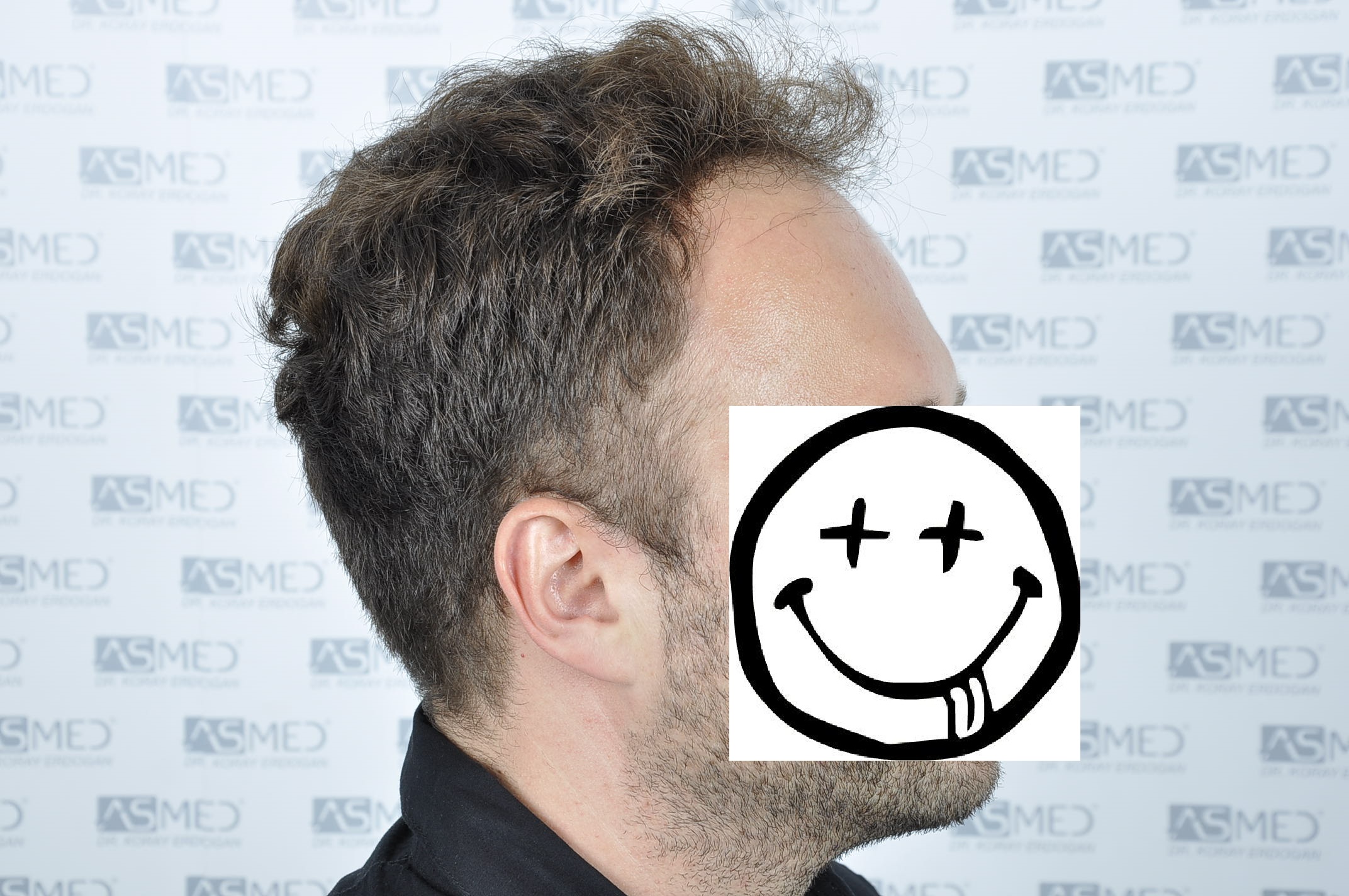 /foren/transplant/index.php/fa/38585/0/