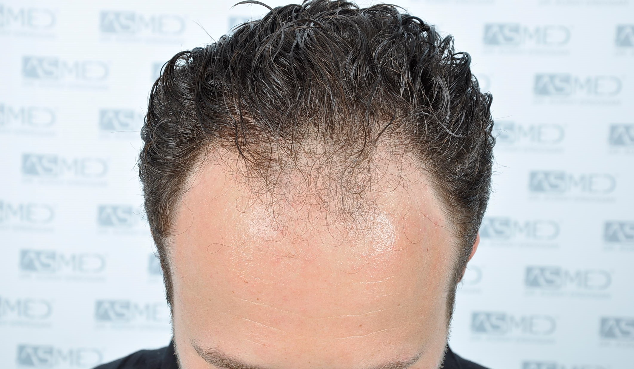 /foren/transplant/index.php/fa/38586/0/