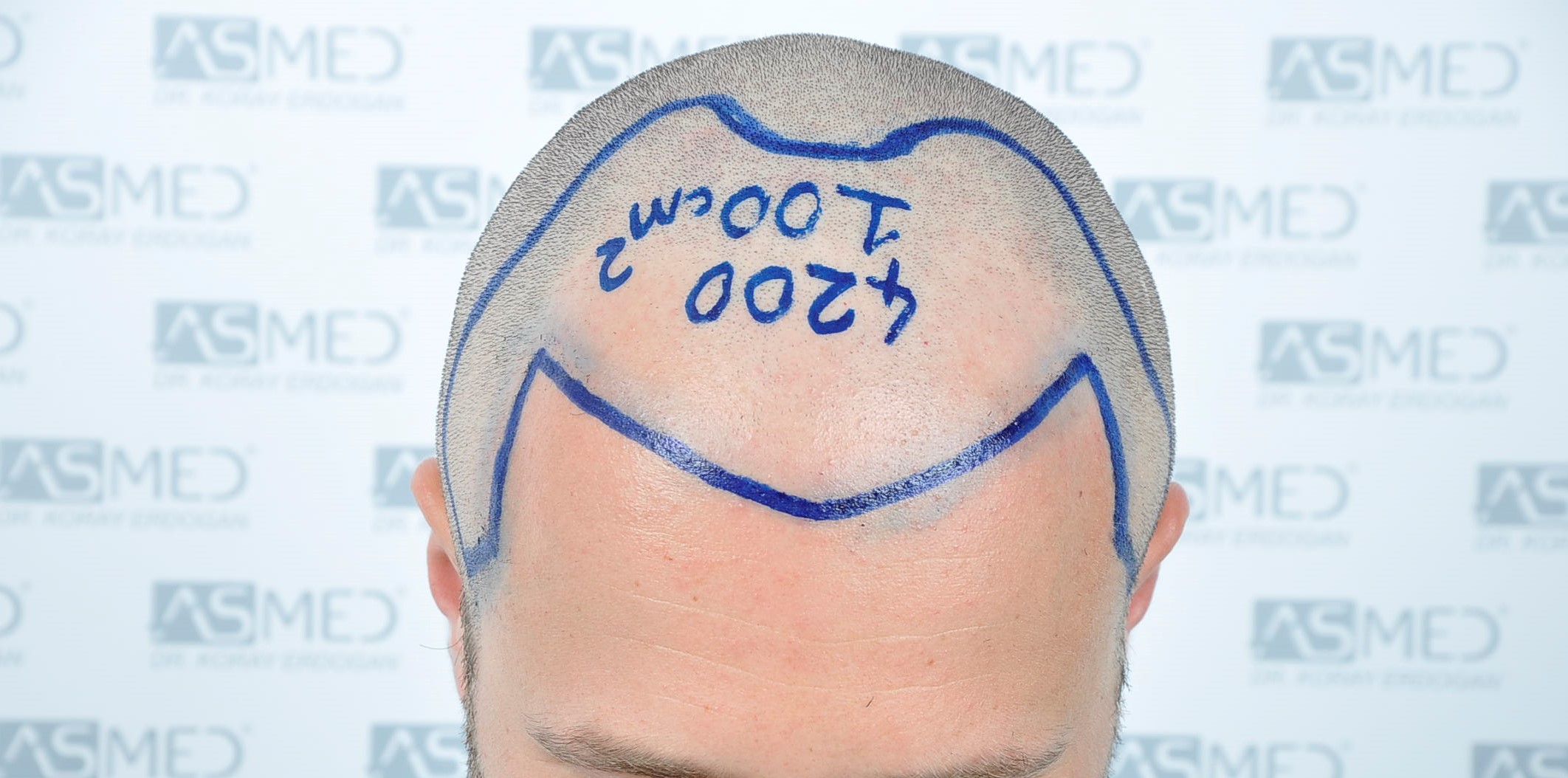 /foren/transplant/index.php/fa/38588/0/