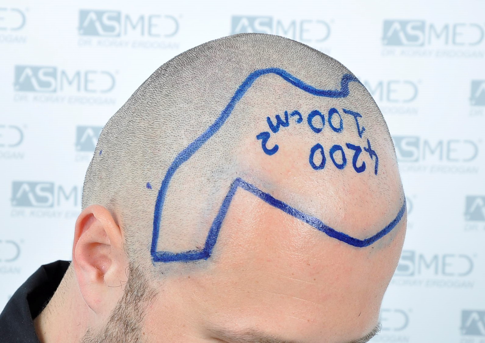 /foren/transplant/index.php/fa/38589/0/