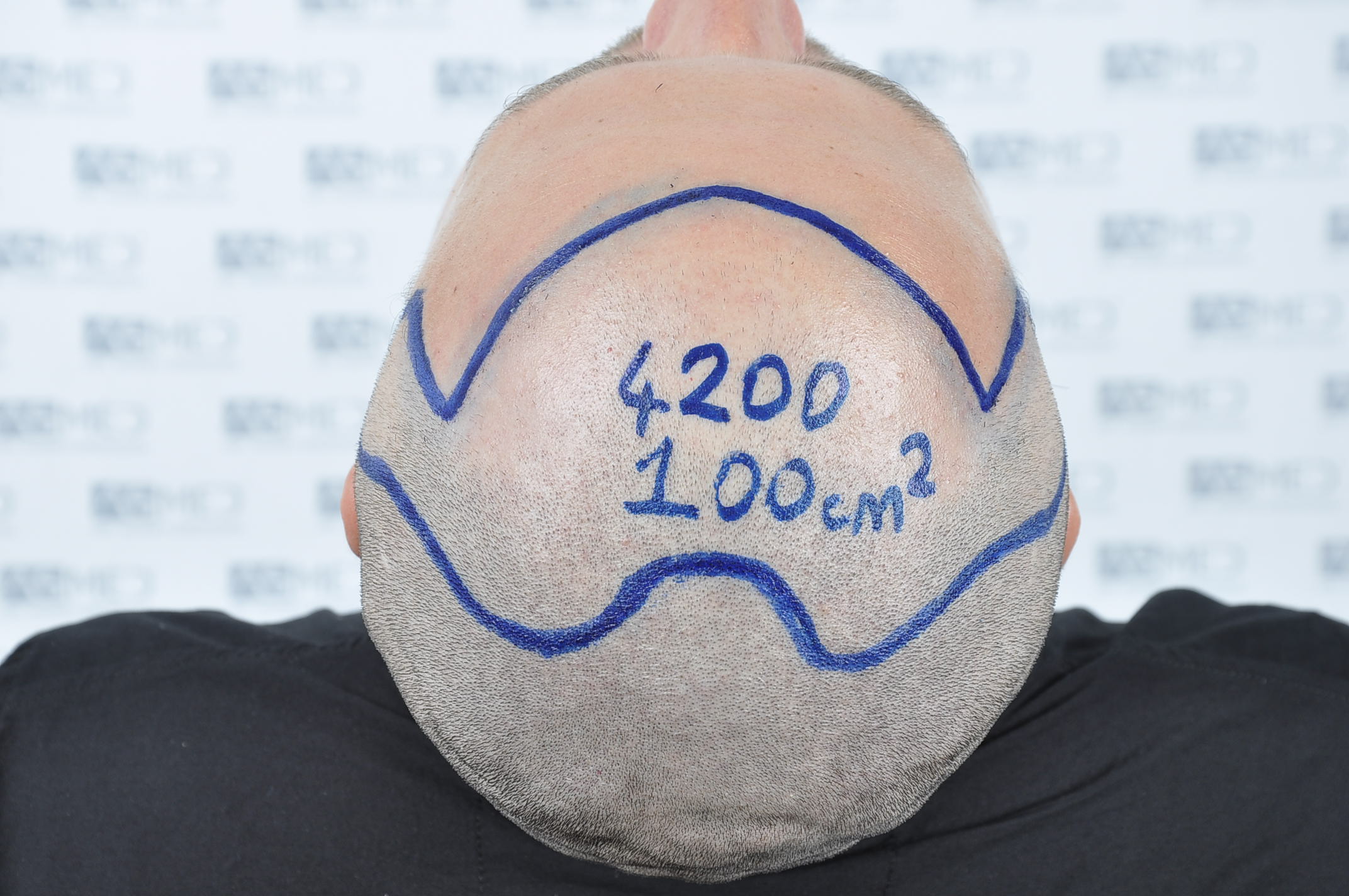 /foren/transplant/index.php/fa/38590/0/