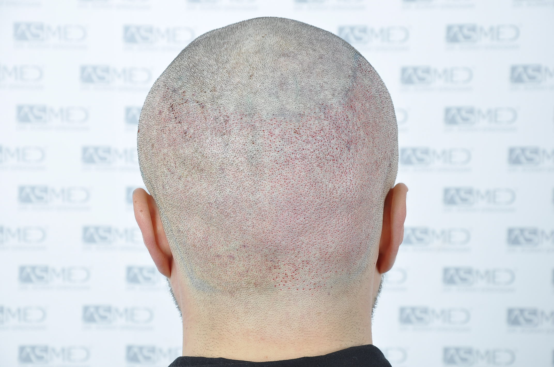 /foren/transplant/index.php/fa/38592/0/