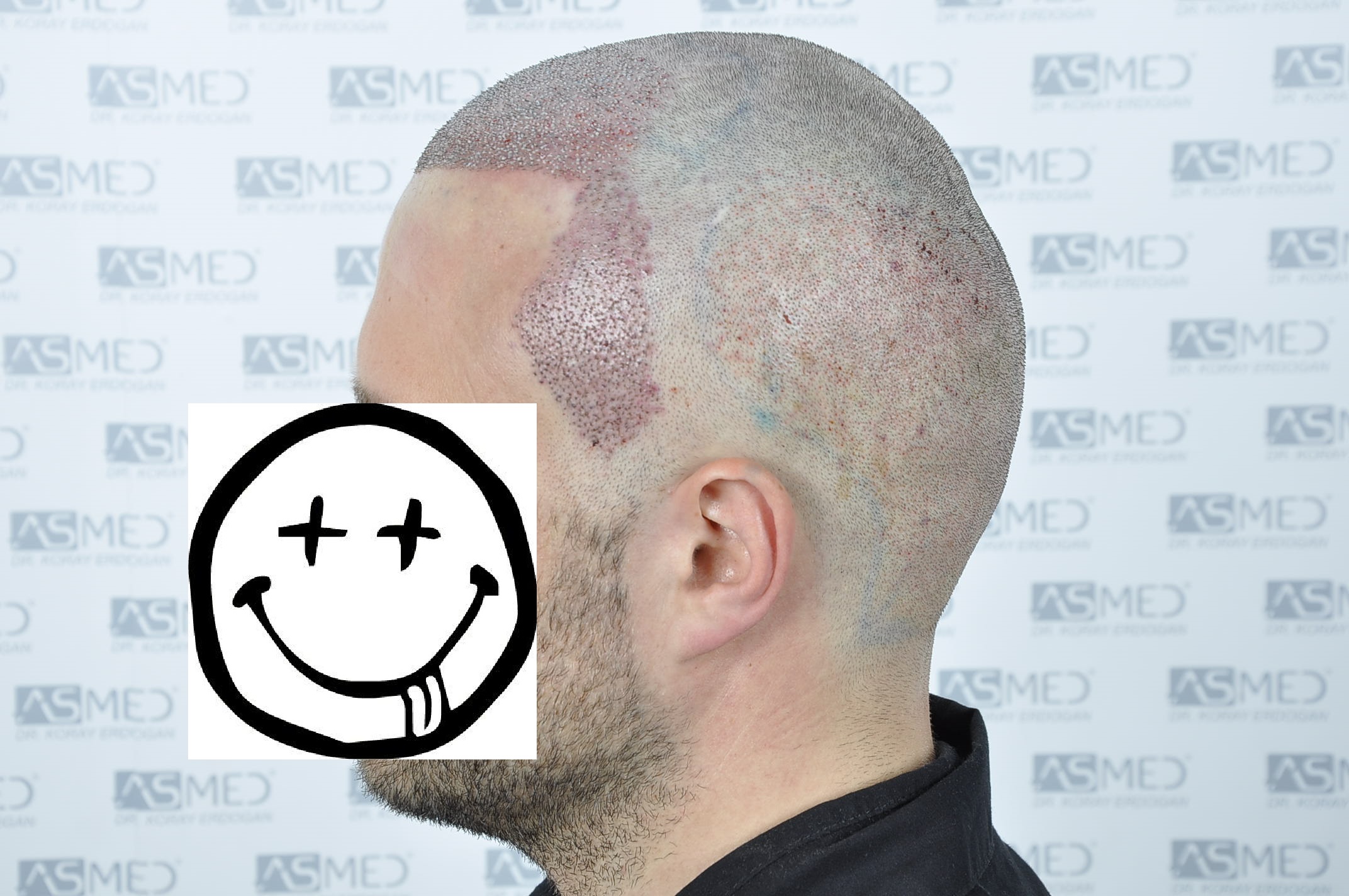 /foren/transplant/index.php/fa/38593/0/