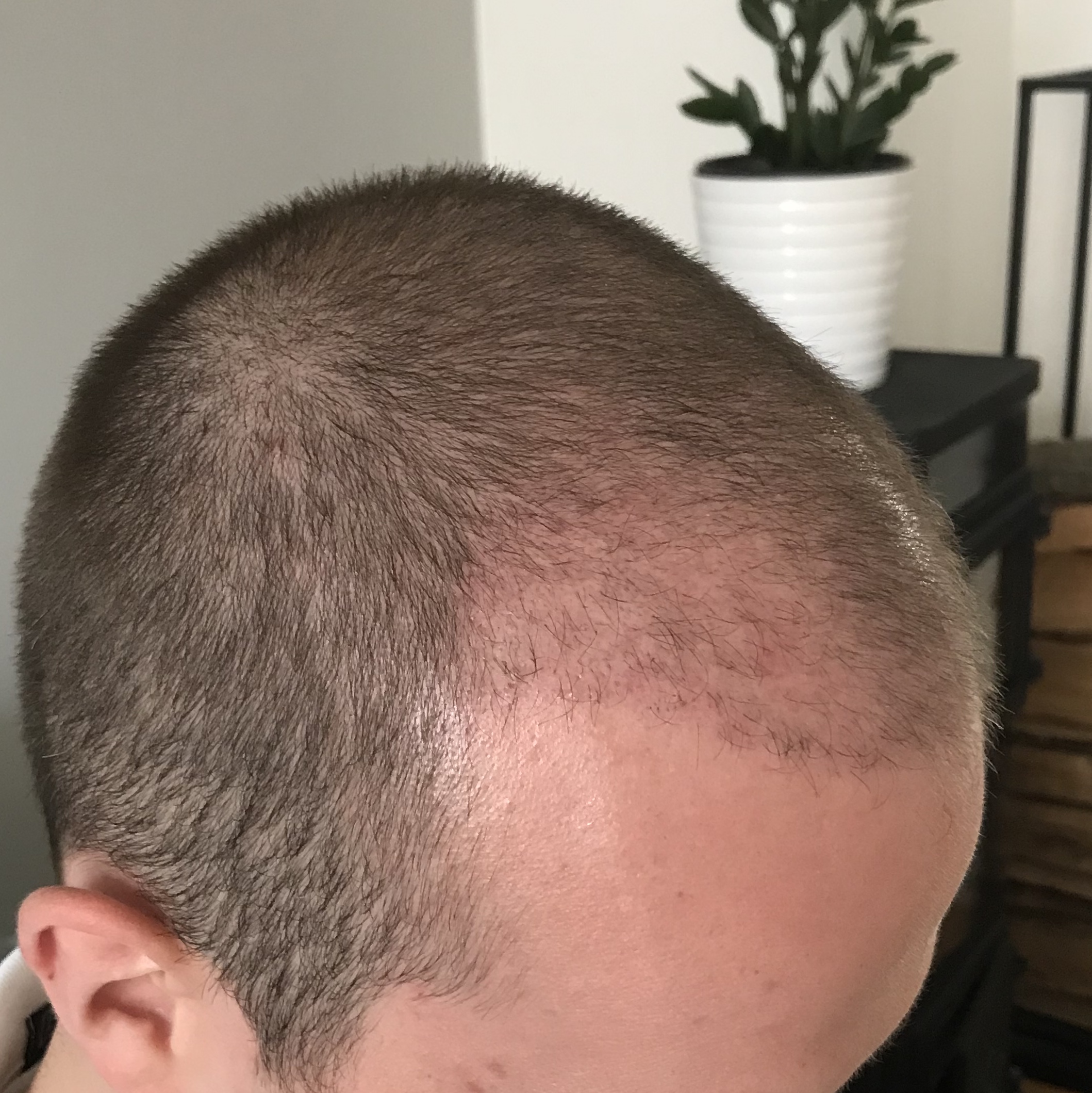 /foren/transplant/index.php/fa/38645/0/