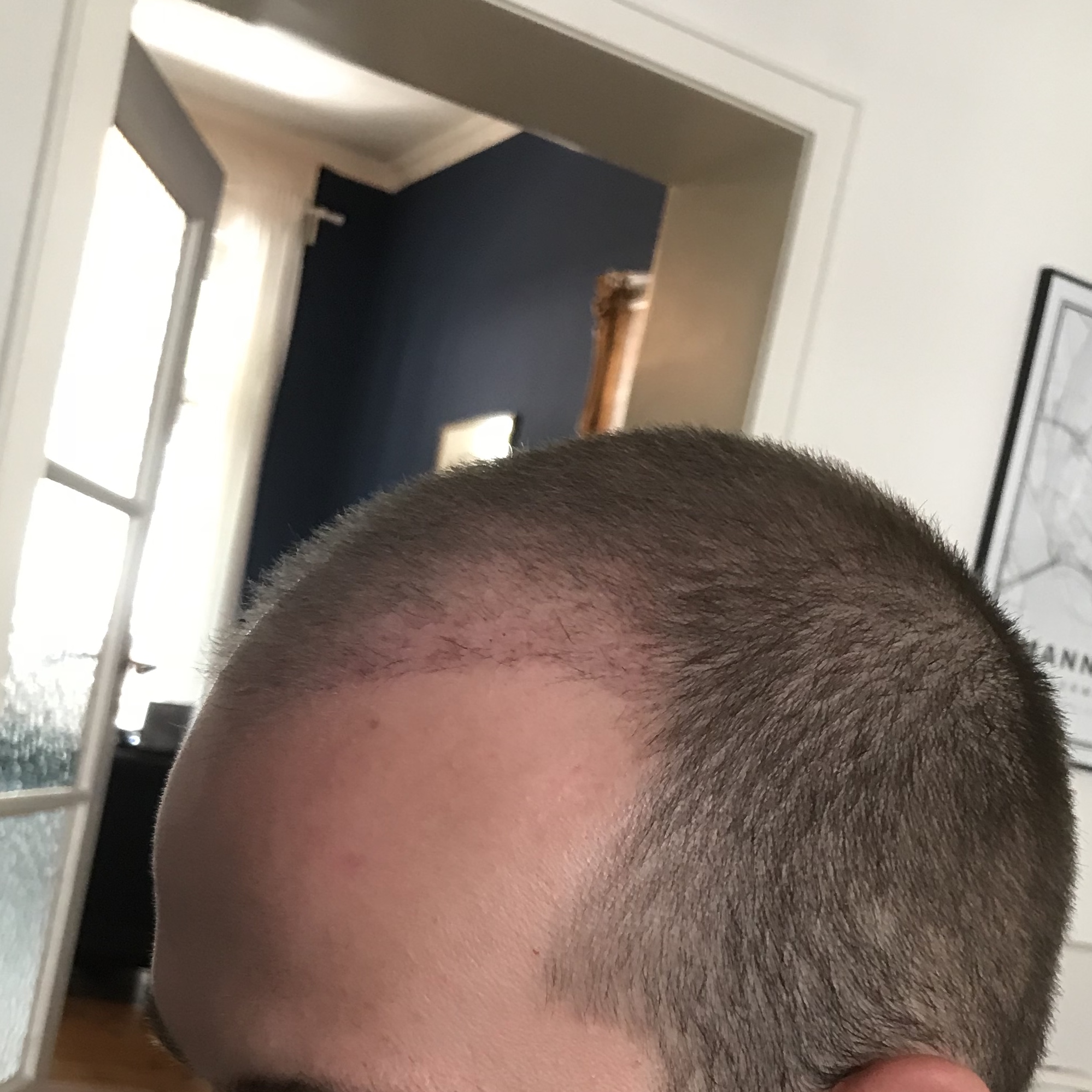 /foren/transplant/index.php/fa/38646/0/