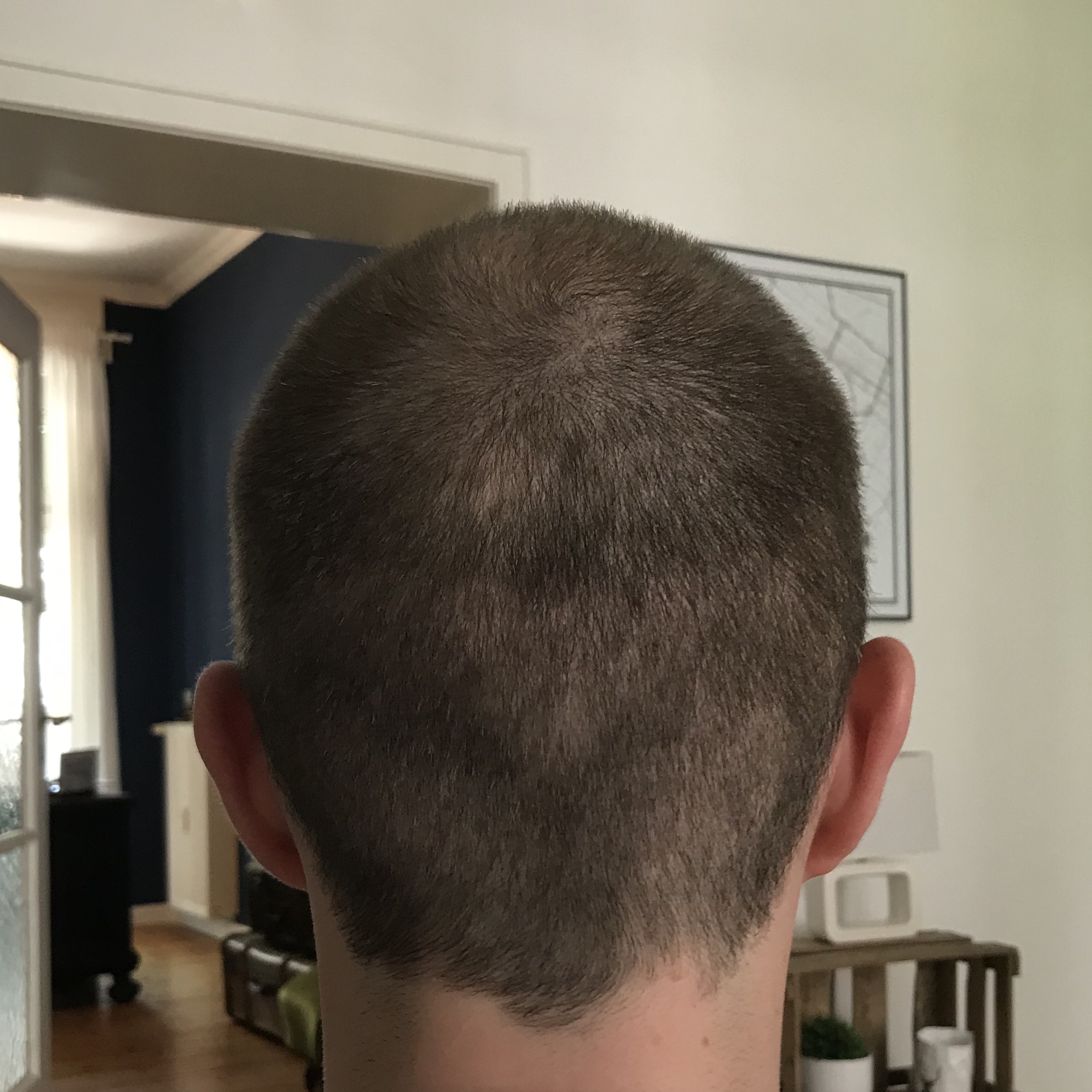 /foren/transplant/index.php/fa/38647/0/