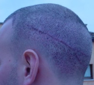 index.php/fa/3866/0/