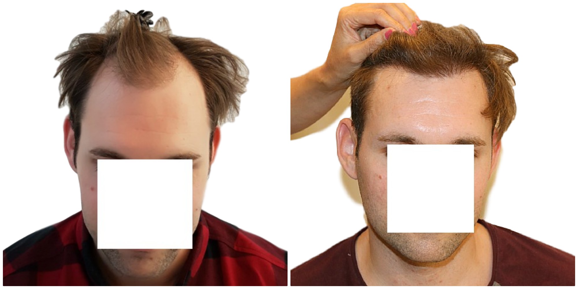 /foren/transplant/index.php/fa/38662/0/