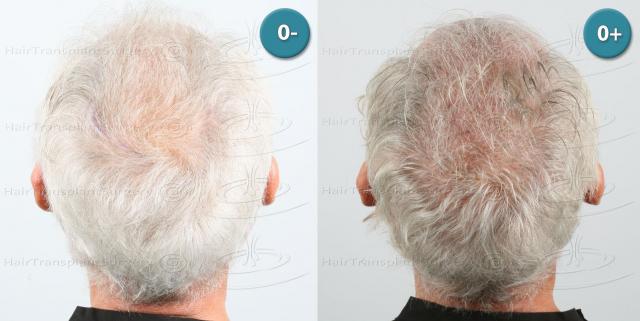 /foren/transplant/index.php/fa/38671/0/