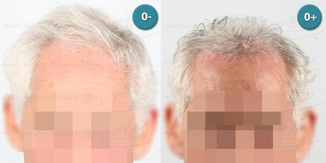 /foren/transplant/index.php/fa/38673/0/