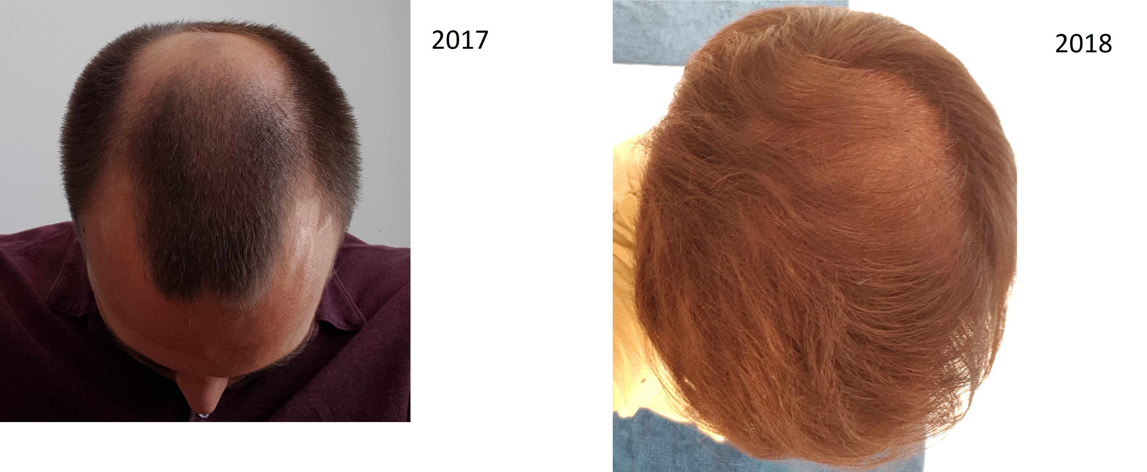 /foren/transplant/index.php/fa/38681/0/