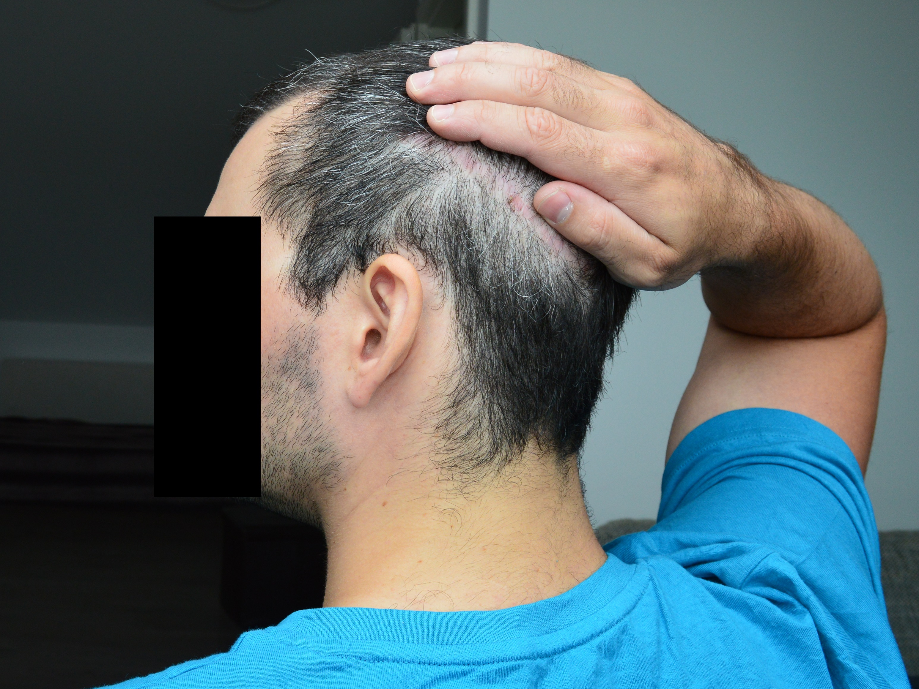 /foren/transplant/index.php/fa/38735/0/