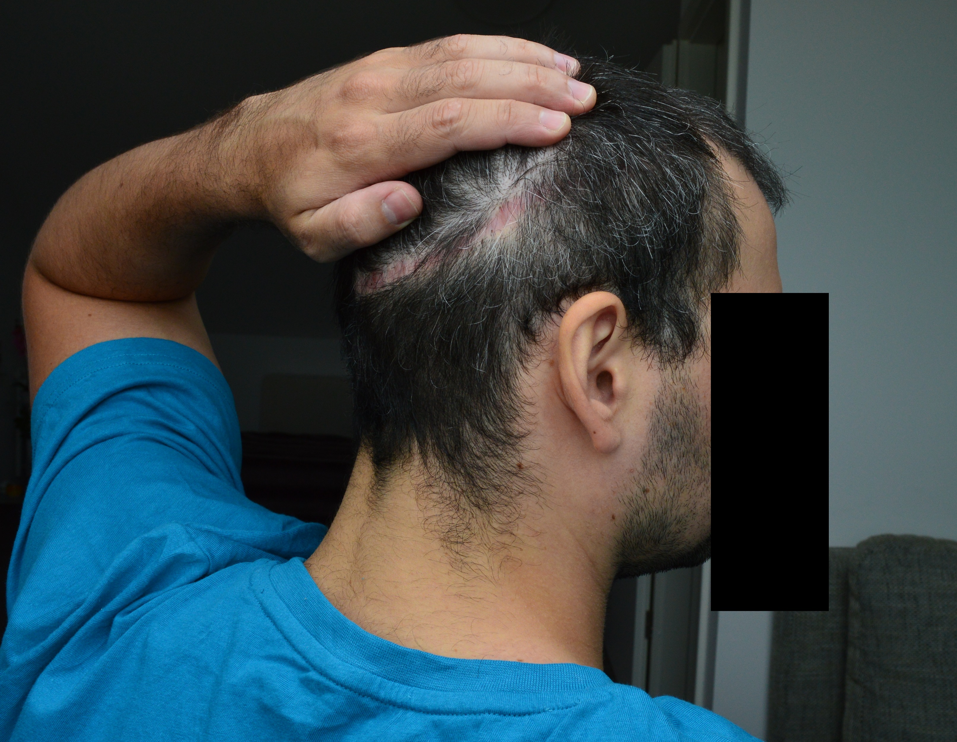 /foren/transplant/index.php/fa/38736/0/