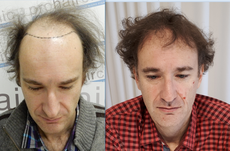 /foren/transplant/index.php/fa/38901/0/