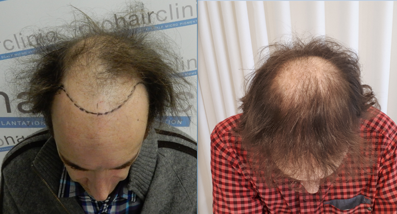 /foren/transplant/index.php/fa/38903/0/