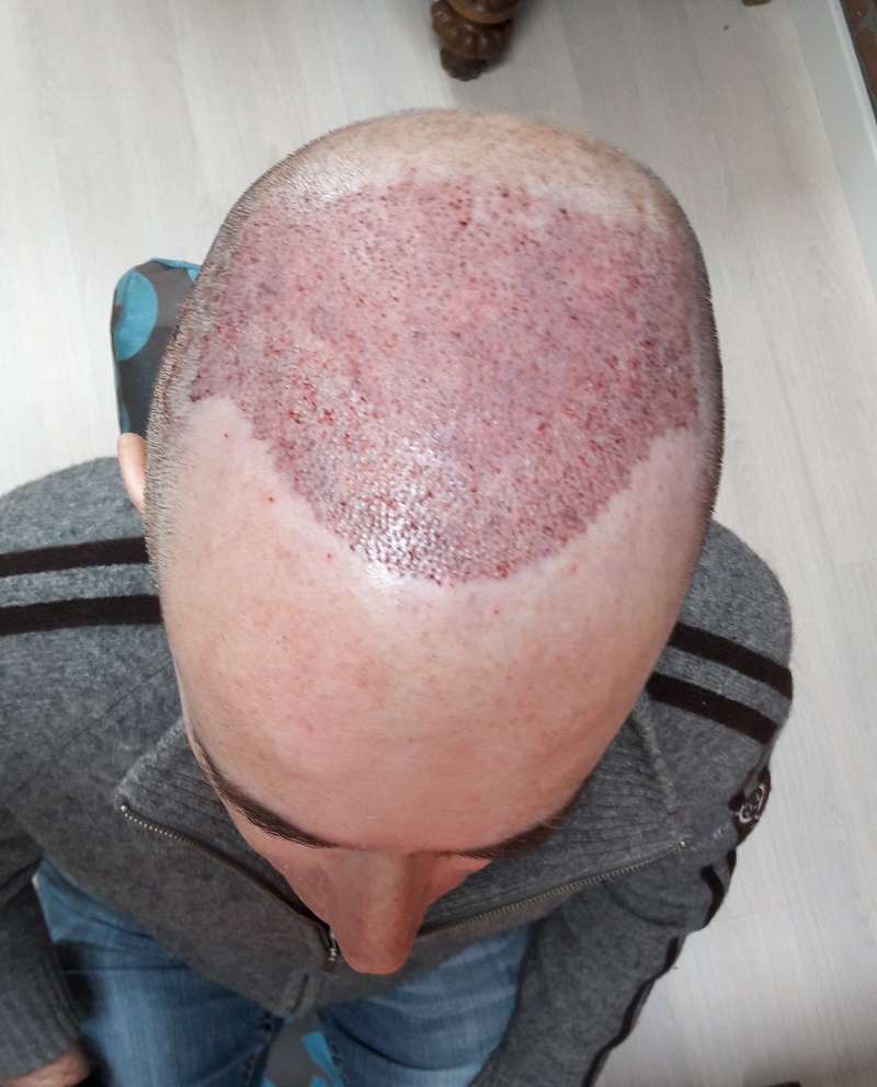 /foren/transplant/index.php/fa/38904/0/