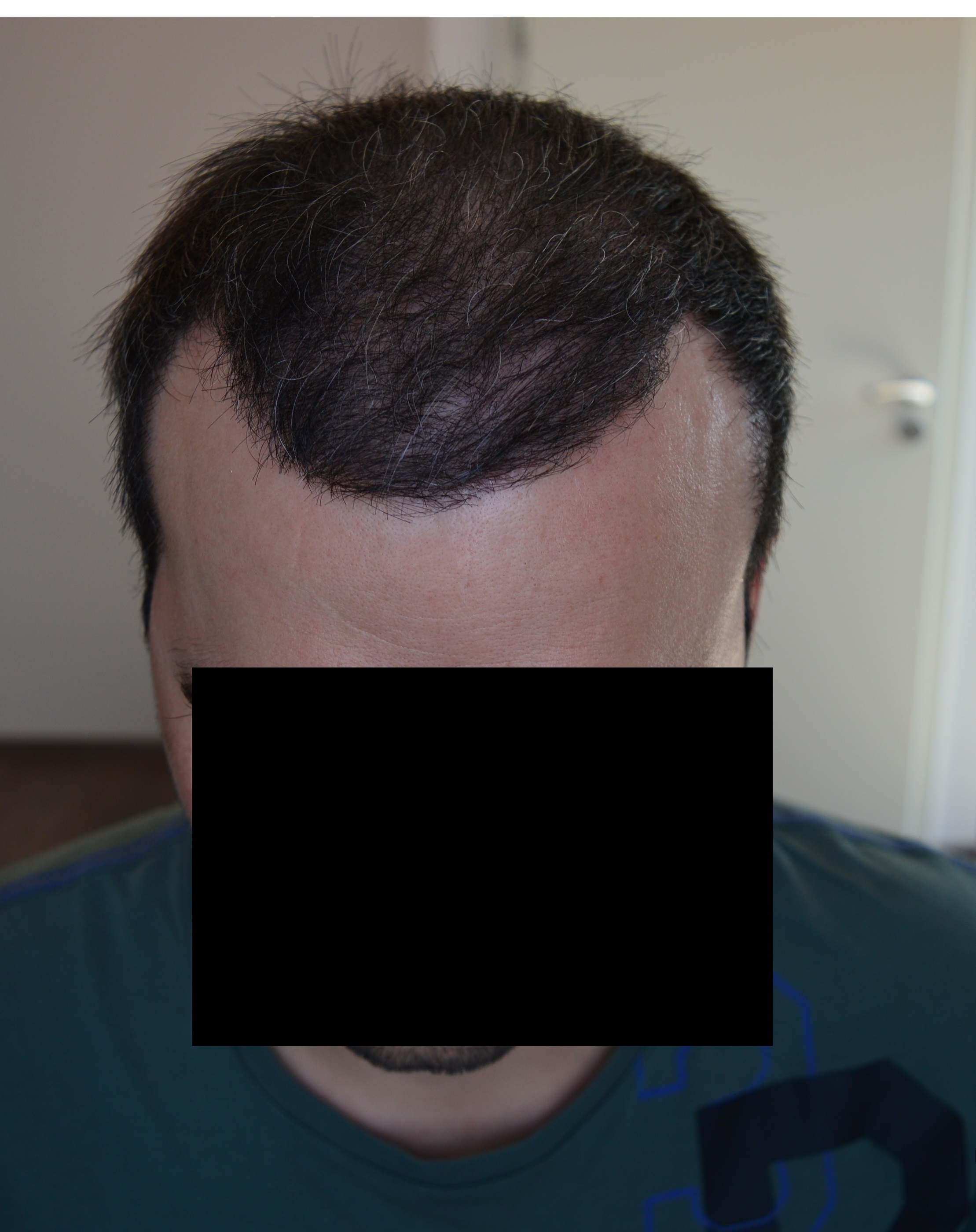 /foren/transplant/index.php/fa/38999/0/