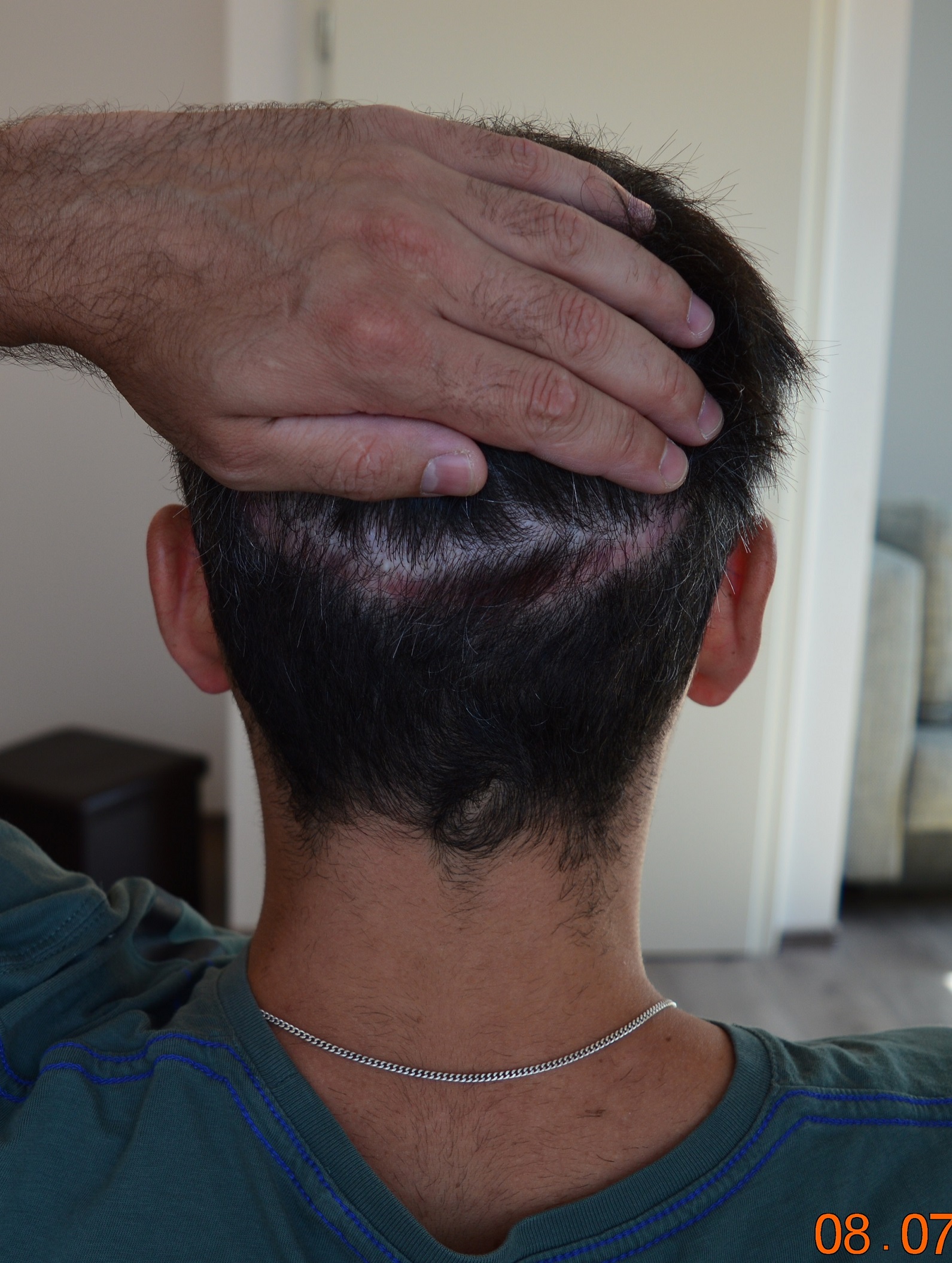 /foren/transplant/index.php/fa/39003/0/