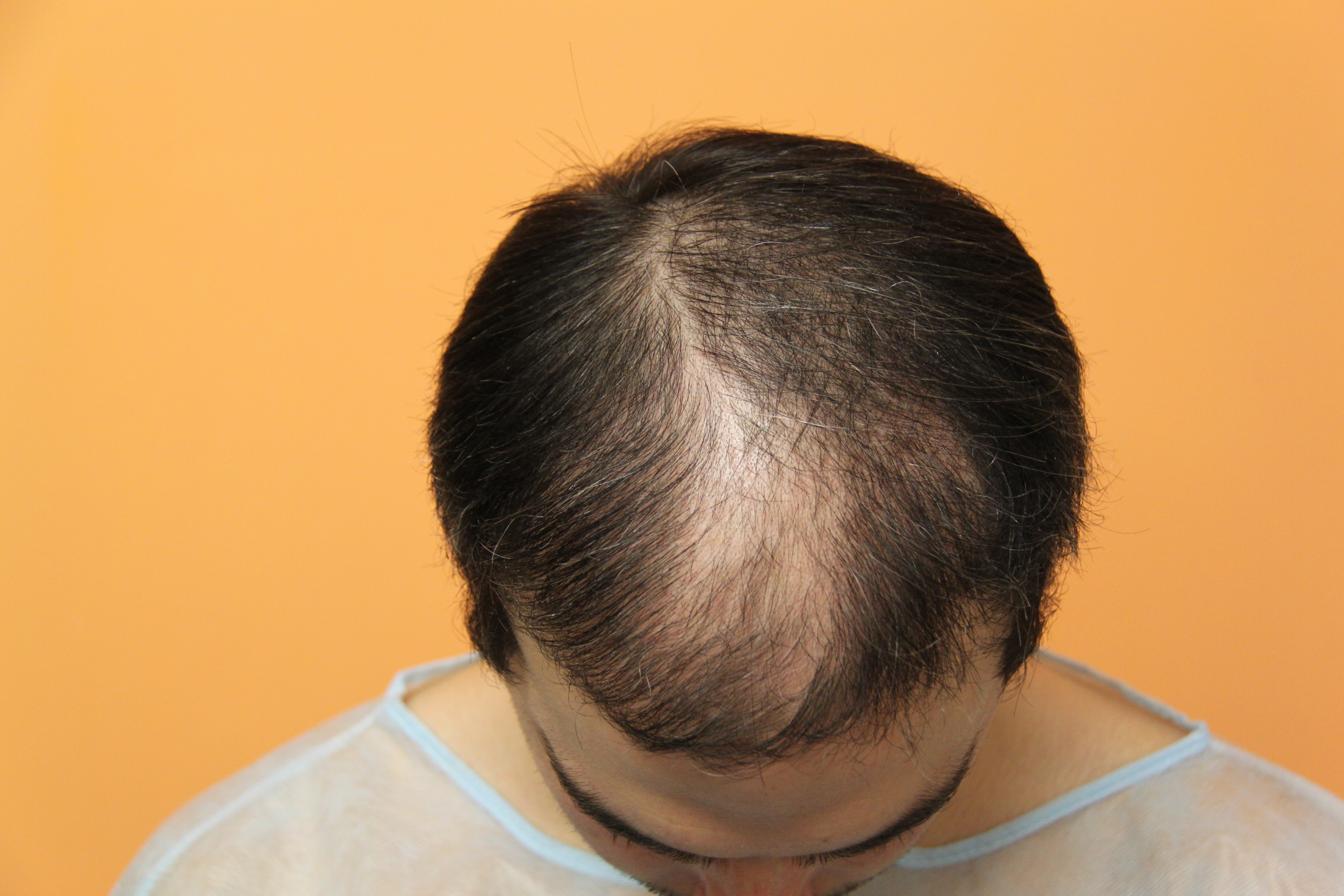 /foren/transplant/index.php/fa/39007/0/