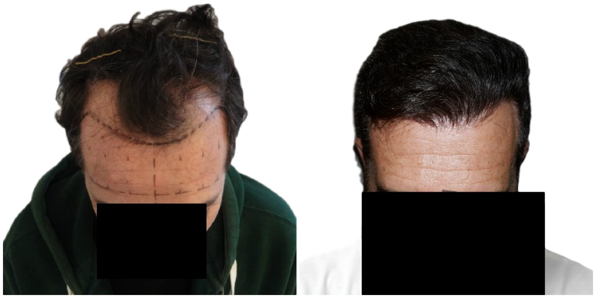 /foren/transplant/index.php/fa/39082/0/