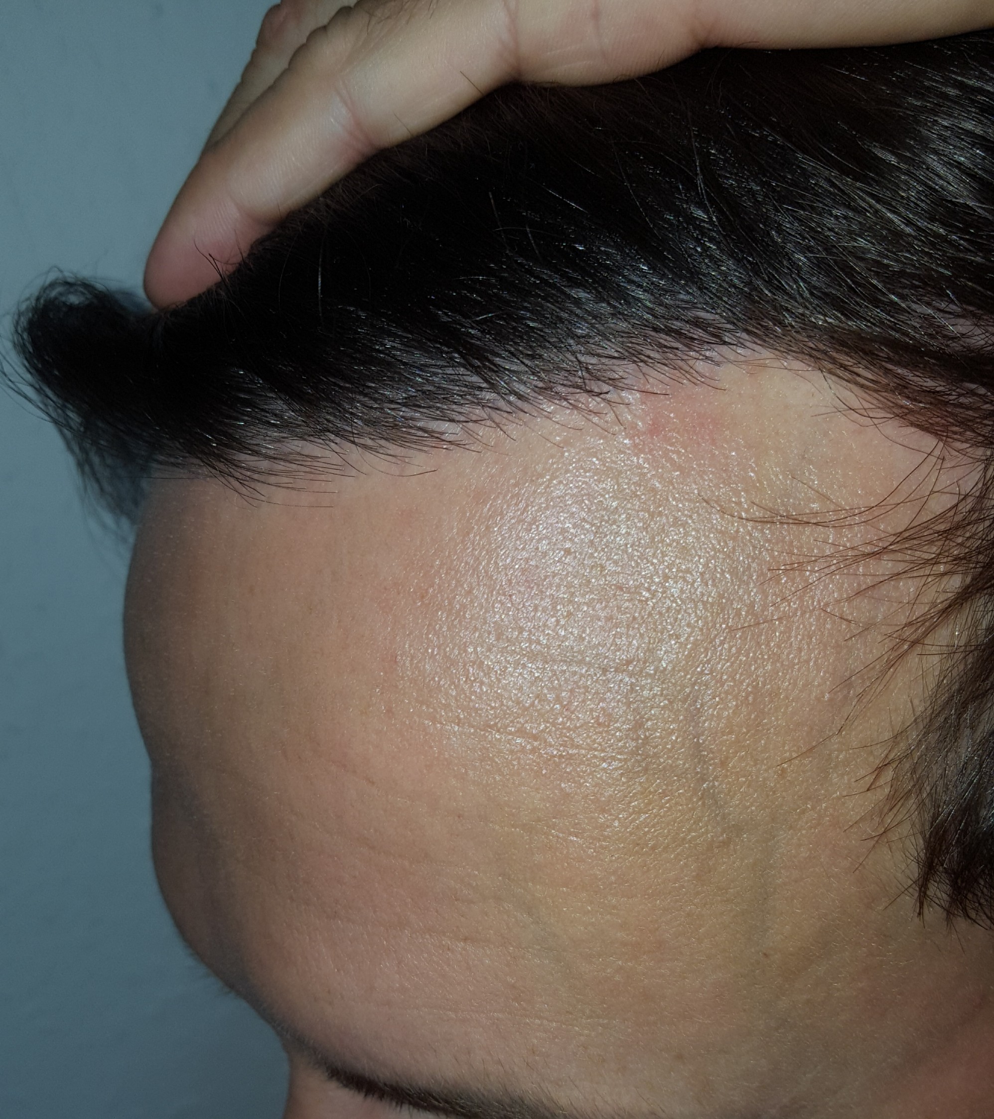 /foren/transplant/index.php/fa/39128/0/