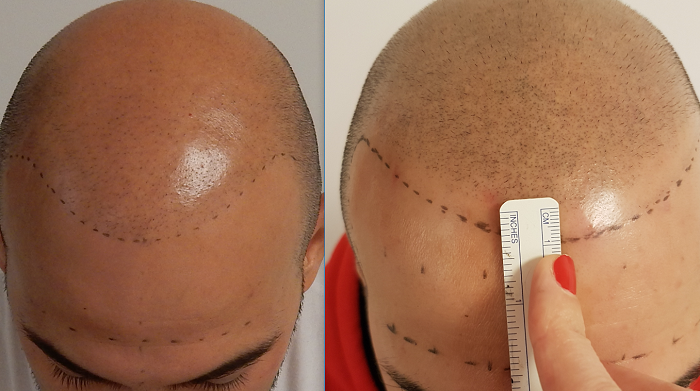 /foren/transplant/index.php/fa/39180/0/