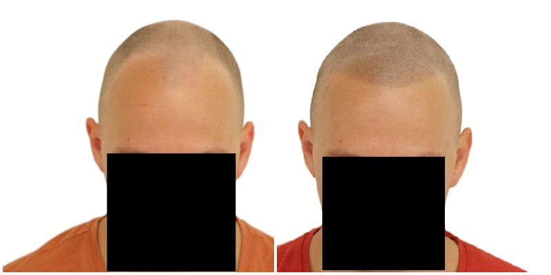 /foren/transplant/index.php/fa/39192/0/