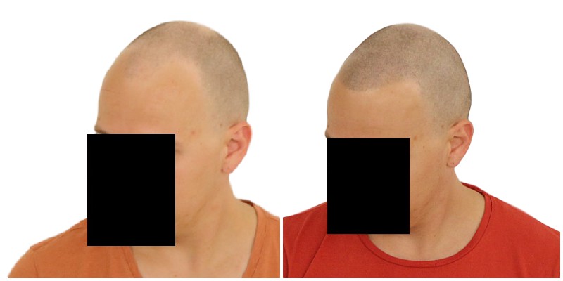 /foren/transplant/index.php/fa/39193/0/