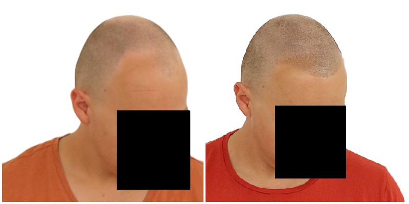 /foren/transplant/index.php/fa/39194/0/